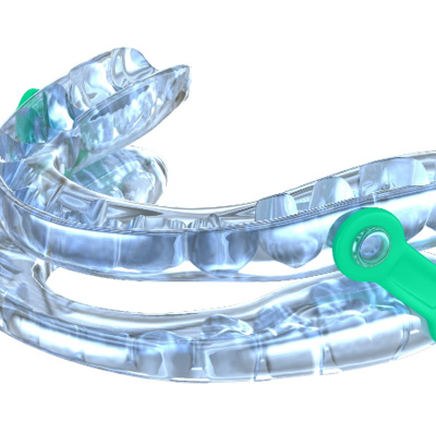 an oral sleep appliance