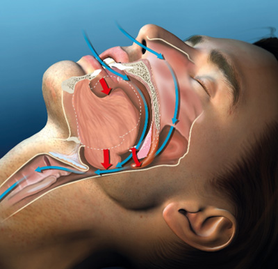 a computer illustration showing airflow while sleeping