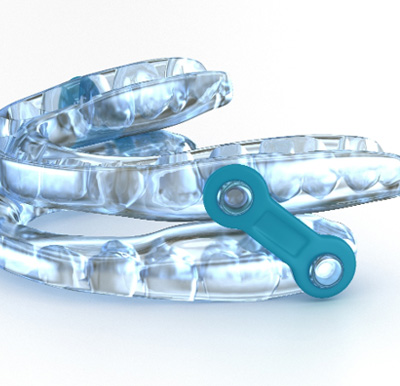 an oral sleep appliance 